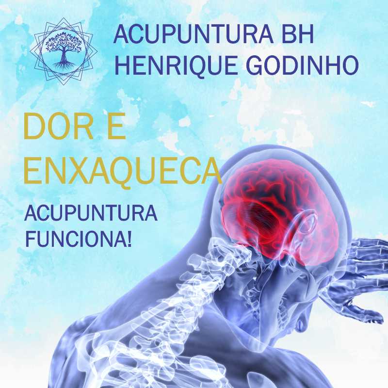 Dor Enxaqueca Acupuntura